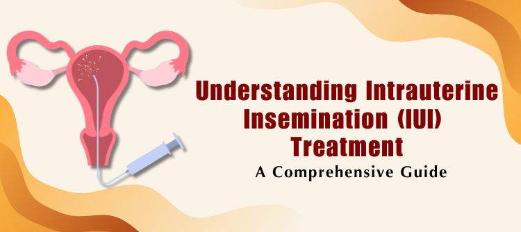 Navigating IUI Your Complete Step-by-Step Guide to Intrauterine Insemination