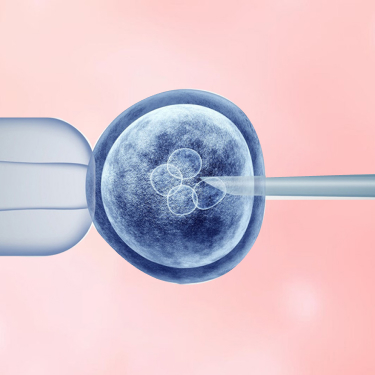 Heart Rhythm Disorder